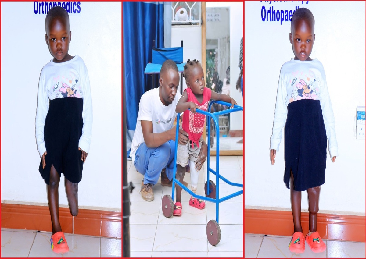 Martha's Success Story at Nkolo Orthopaedics Rehabilitation Center (NORC)